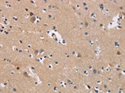 AXIN2 Antibody