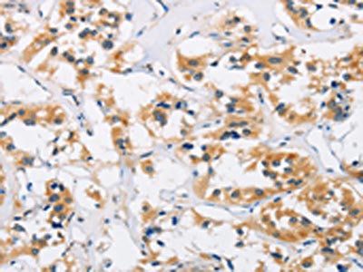 AXIN2 Antibody