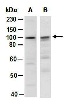 AXIN2 (C1) Antibody, Rabbit Polyclonal