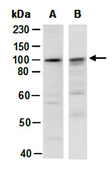 AXIN2 (C2) Antibody, Rabbit Polyclonal