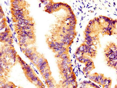 AXL Antibody