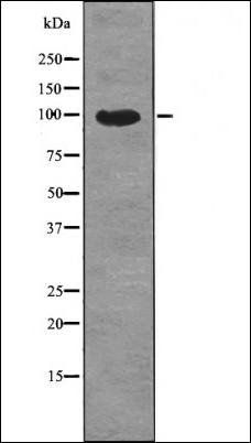 AXL (Phospho-Tyr691) antibody