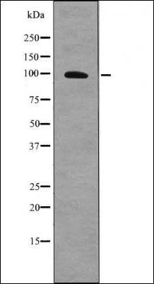 AXL (Phospho-Tyr702) antibody
