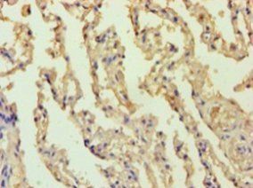 B-cell lymphoma/leukemia 10 antibody