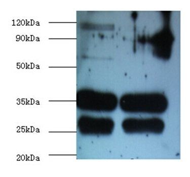 BCAP31 Antibody