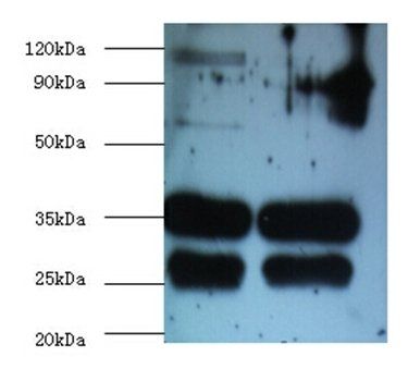 B-cell R-associated protein 31 antibody