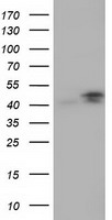 B Raf (BRAF) antibody