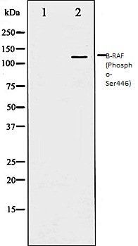 B-RAF (Phospho-Ser446) antibody