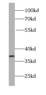 B23 antibody
