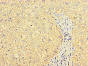 B3GALT2 Antibody
