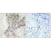 B3GALTL Antibody