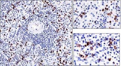 CD57 / B3GAT1 (Natural Killer Cell Marker) Antibody