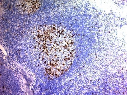 CD57 / B3GAT1 (Natural Killer Cell Marker) Antibody