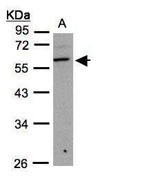 B3GNT3 Rabbit Polyclonal Antibody