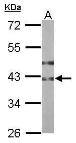 B3GNT3 Rabbit Polyclonal Antibody