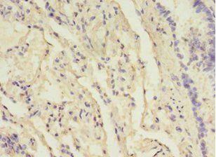 B3GNT5 Antibody
