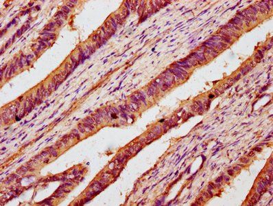 B3GNT6 Antibody