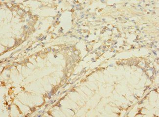 B4GALNT2 Antibody