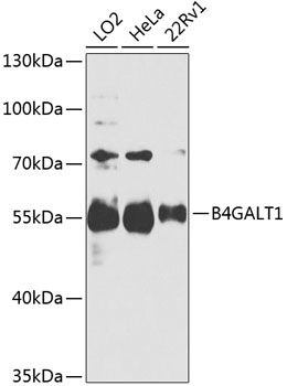B4GALT1 antibody