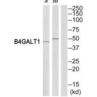 B4GALT1 antibody