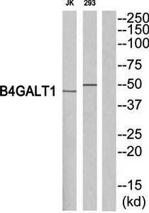 B4GALT1 antibody