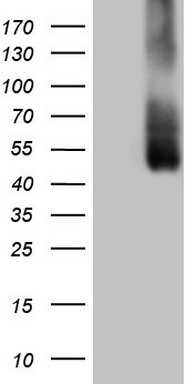 B4GALT4 antibody