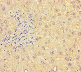B4GALT5 Antibody