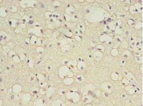 B4GAT1 Antibody