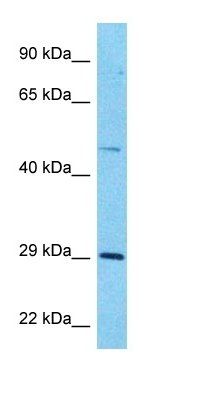 B4GT1 antibody