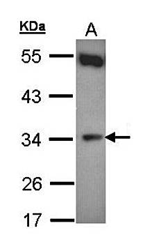 b5R.1 antibody