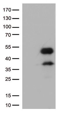 B7-2 (CD86) antibody