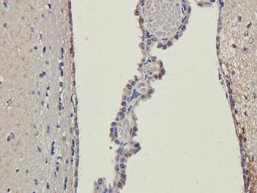 B7-H6 antibody