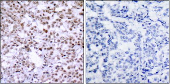 Chk2 antibody