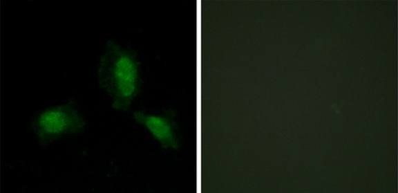 IRS-1 antibody