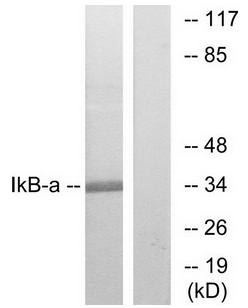 I kappa B-alpha antibody