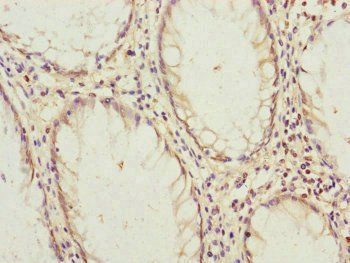 B9D2 Antibody