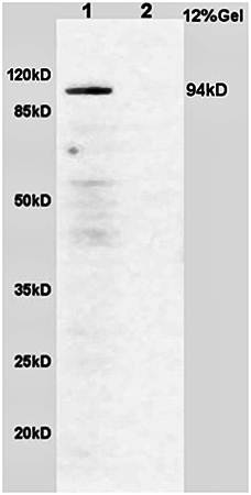 B Raf (phospho-S365) antibody