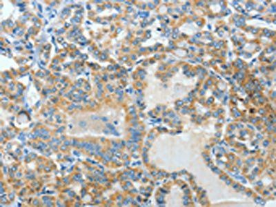 BAAT Antibody