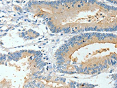 BAAT Antibody