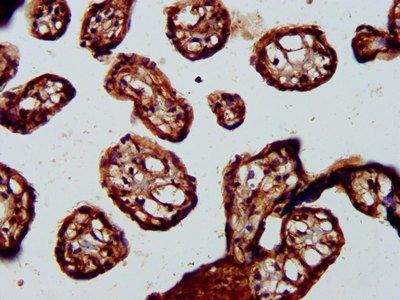 BABAM2 Antibody
