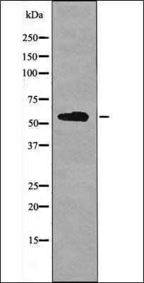 BACE (Phospho-Ser498) antibody