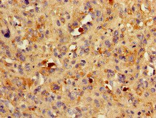 BACE1 Antibody