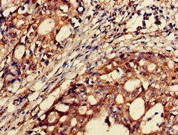 BACE2 Antibody