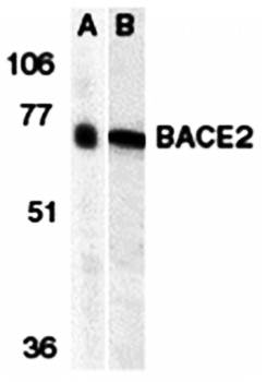 BACE2 Antibody