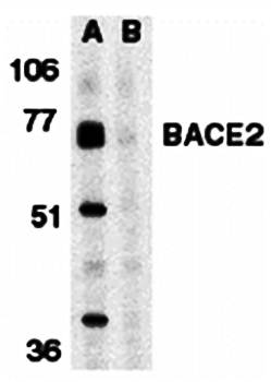BACE2 Antibody