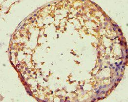 BACH1 Antibody