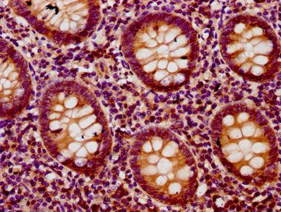 BACH2 Antibody