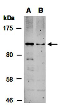BACH2 (C) Antibody, Rabbit Polyclonal