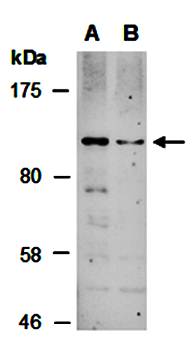 BACH2 antibody