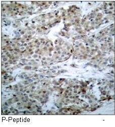 BAD (Phospho-Ser112) Antibody